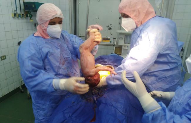 "صحة الدقهلية": نجاح ولادة قيصرية لسيدة مصابة بكورونا |صور