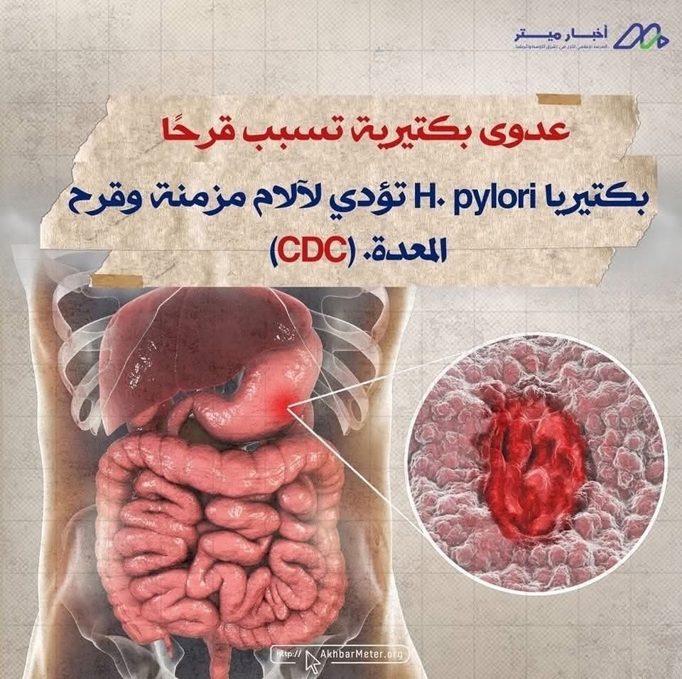 آلام المعدة: متى يكون الانزعاج عرضًا لمشكلة أعمق؟