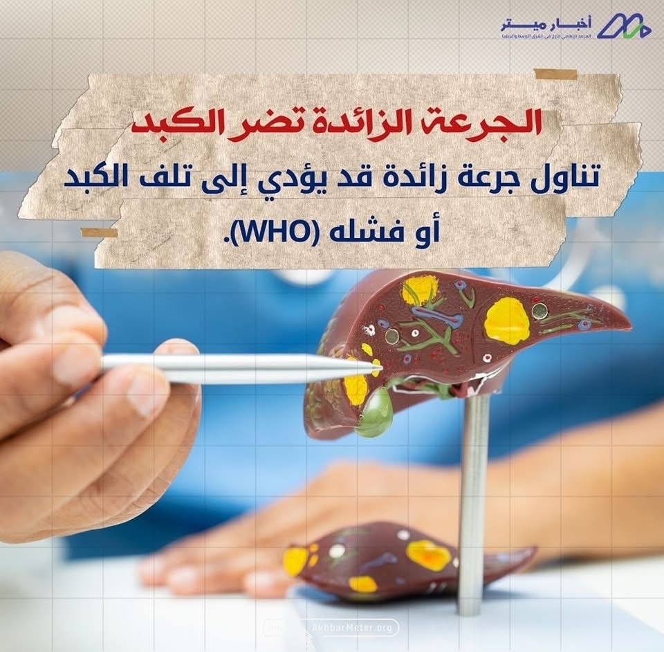 الباراسيتامول: مسكن شائع… لكن هل هو آمن دائمًا؟